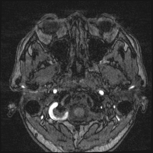 Click on the Serie image to view the images of VILLANUEVA, WILLIAM A.